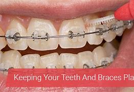 Image result for How to Avoid Plaque On Teeth