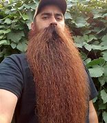 Image result for Cheek Beard