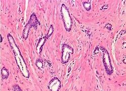 Image result for Human Tissue Acyt