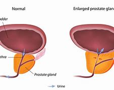 Image result for Prostate Gland Structure