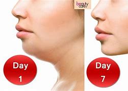 Image result for Double Chin Face