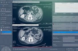 Image result for IRM Abdominal