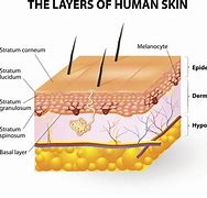 Image result for Skin Laceration Down to the Dermis