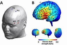 Image result for tDCS Placement Map