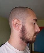 Image result for Cheek Beard