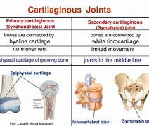 Image result for Examples of Cartilaginous Joints