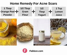 Image result for Acne Scars Home Remedy