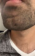 Image result for Chin Indent