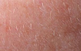 Image result for Face Mites