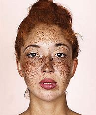 Image result for Interesting Faces Freckles