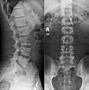 Image result for Lumbar and Sacral Spine