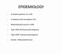 Image result for Charcot Bone Disease