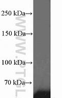 Image result for SSB Antibody