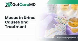 Image result for Muco Urine