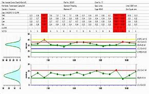 Image result for Excel Bar Chart Templates Free