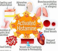 Image result for Post Pico Genesis Histamine Reaction