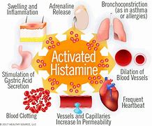 Image result for Histamine Reaction