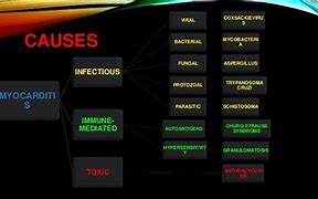 Image result for Myocarditis Treatment