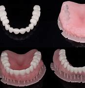 Image result for Printed Dentures