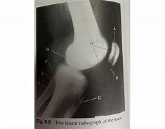 Image result for Normal Lateral Knee Radiograph