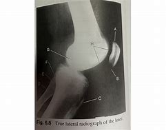 Image result for Lateral Knee Radiograph