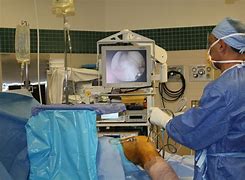 Image result for Arthroscopic Surgery Meniscus