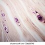 Image result for Trichinosis Parasite