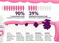 Image result for Human Body Colon Cancer