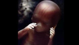 Image result for 16 Weeks Baby in Womb