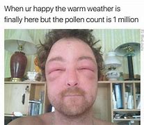 Image result for Allergic Meme