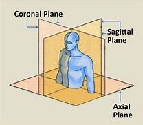 Image result for CT Scan Views