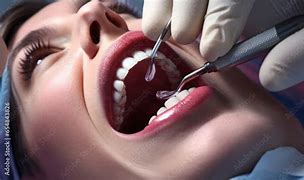 Image result for Tooth Extraction Painless