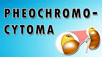 Image result for Pheochromocytoma Renin