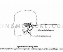 Image result for Ernest Syndrome