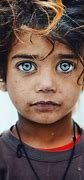 Image result for Austic Kids Eyes