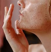 Image result for Mites On Face