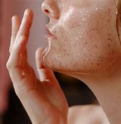 Image result for Mites On Face Skin Infection