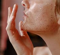 Image result for Itch Mites On Face