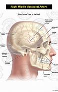 Image result for Middle Meningeal Artery Grove of Skull