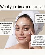 Image result for Pustules On Forehead