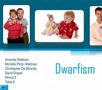 Image result for Pseudo Dwarfism