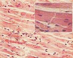 Image result for Cardiac Muscle Bundles