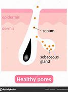 Image result for Hard Sebum in Pores