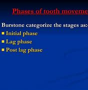 Image result for Propel Tooth Movement