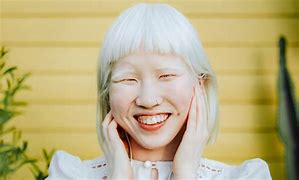 Image result for Albino Elg