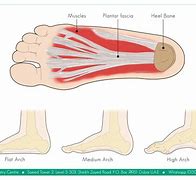 Image result for Thug Plantar