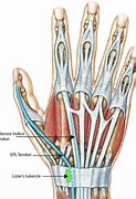 Image result for Thumb Extensor Tendonitis