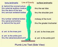 Image result for Plumb Line On Human Body