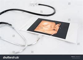 Image result for Baby Ultrasound Photo