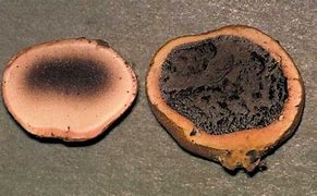 Image result for Scleroderma Sp